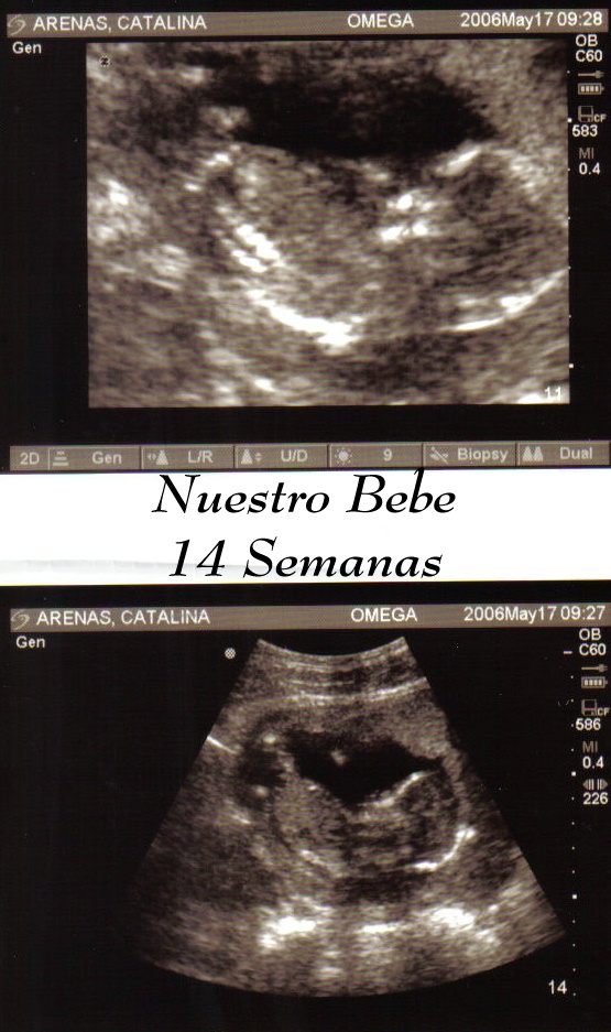 nuestro bebe 14 semanas..jpg